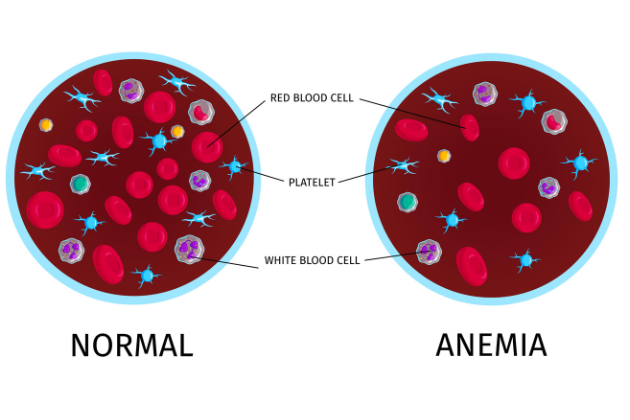 RBC Plus Capsule: Your Ayurvedic Medicine for Anemia