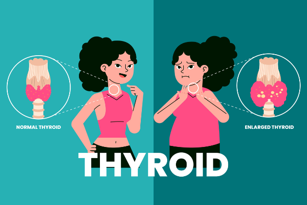 Hypothyroidism: Root Causes and Key Symptoms