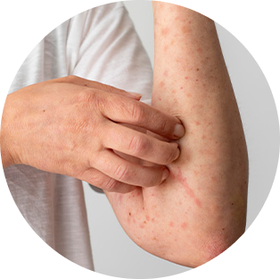 Allergy Support